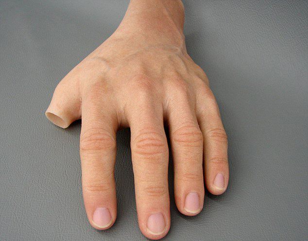 手部假肢價(jià)格多少錢以及假肢有哪些類型(圖1) 手部假肢價(jià)格多少錢以及假肢有哪些類型(圖1)