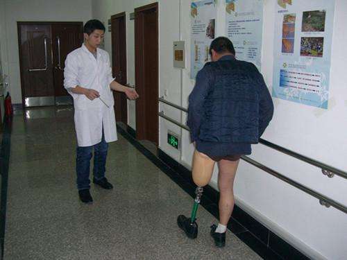 裝配假肢的理想殘肢長(zhǎng)什么樣?(圖1) 假肢